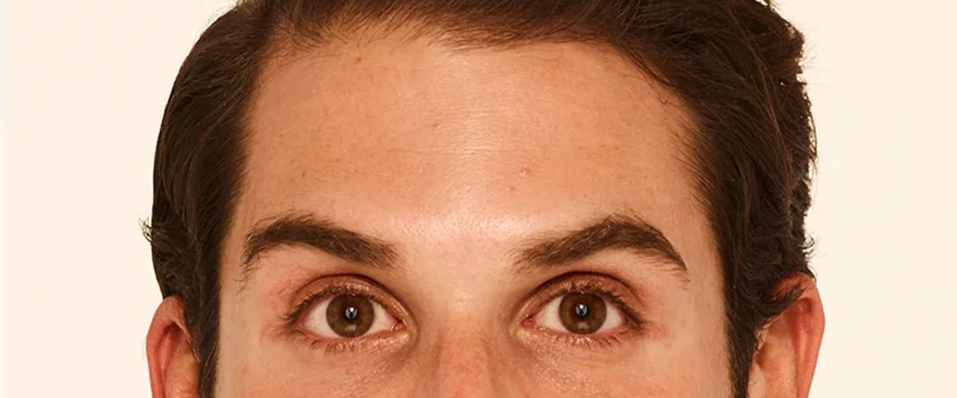 andalusia-Alabama-botox